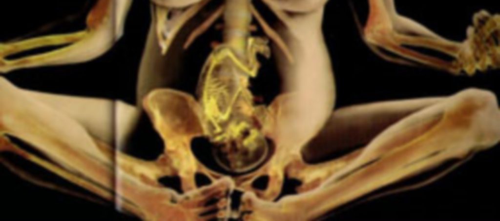 Although pelvic pain is commonly associated with pregnancy, it can affect both men and women of all ages